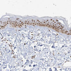 Immunohistochemical staining of human skin shows moderate nuclear positivity in epidermal cells.