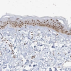Immunohistochemical staining of human skin shows moderate nuclear positivity in epidermal cells.