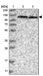 Lane 1: Marker [kDa] 230, 130, 95, 72, 56, 36, 28, 17, 11_br/_Lane 2: Human cell line RT-4_br/_Lane 3: Human cell line U-251MG sp