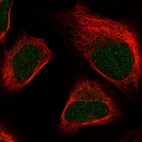 Immunofluorescent staining of human cell line U-2 OS shows positivity in nucleus.