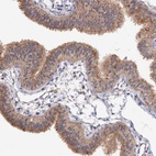 Anti-NUDCD2 Antibody