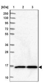 Lane 1: Marker [kDa] 250, 130, 95, 72, 55, 36, 28, 17, 10_br/_Lane 2: Human cell line RT-4_br/_Lane 3: Human cell line U-251 MG