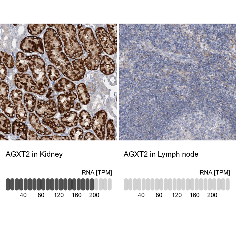 Anti-AGXT2 Antibody
