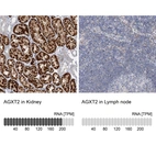 Anti-AGXT2 Antibody
