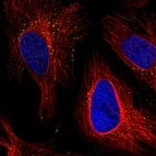 Immunofluorescence staining in HeLa cell line with Anti-VSP26A monoclonal antibody, showing distinct staining of endosomes in green. Microtubule- and nuclear probes are visualized in red and blue respectively (where available).