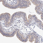 Anti-NUDCD2 Antibody