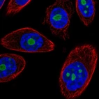 Immunofluorescent staining of human cell line PC-3 shows localization to nucleoli.