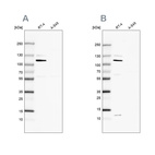 Western blot analysis using Anti-MCC antibody HPA037391 (A) shows similar pattern to independent antibody HPA037390 (B).