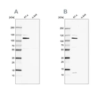 Western blot analysis using Anti-MCC antibody HPA037391 (A) shows similar pattern to independent antibody HPA037390 (B).