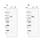 Western blot analysis using Anti-MCC antibody HPA037390 (A) shows similar pattern to independent antibody HPA037391 (B).