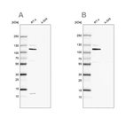 Western blot analysis using Anti-MCC antibody HPA037390 (A) shows similar pattern to independent antibody HPA037391 (B).