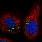 Immunofluorescence staining in A431 cell line with Anti-VSP26A monoclonal antibody, showing distinct staining of endosomes in green. Microtubule- and nuclear probes are visualized in red and blue respectively (where available).