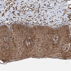 Immunohistochemical staining of human skin shows strong cytoplasmic positivity in squamous epithelial cells.