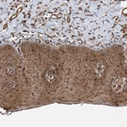 Immunohistochemical staining of human skin shows strong cytoplasmic positivity in squamous epithelial cells.