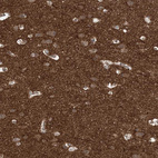 Immunohistochemical staining of human cerebral cortex shows strong cytoplasmic positivity in neuropil.