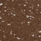 Immunohistochemical staining of human cerebral cortex shows strong cytoplasmic positivity in neuropil.