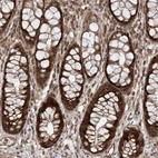 Immunohistochemical staining of human rectum shows strong cytoplasmic positivity in glandular cells.