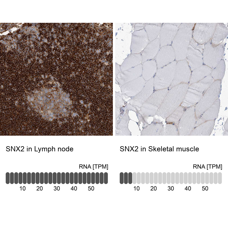 Anti-SNX2 Antibody