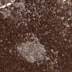 Immunohistochemical staining of human lymph node shows strong membranous positivity in non-germinal center cells.