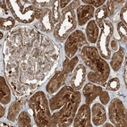 Immunohistochemical staining of human kidney shows strong cytoplasmic positivity in cells in tubules.