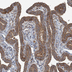 Immunohistochemical staining of human Fallopian tube shows moderate cytoplasmic positivity in glandular cells.