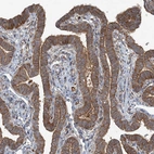 Immunohistochemical staining of human Fallopian tube shows moderate cytoplasmic positivity in glandular cells.