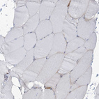 Immunohistochemical staining of human skeletal muscle shows no positivity in myocytes as expected.
