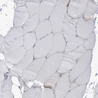 Immunohistochemical staining of human skeletal muscle shows no positivity in myocytes as expected.