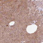 Anti-IQGAP2 Antibody
