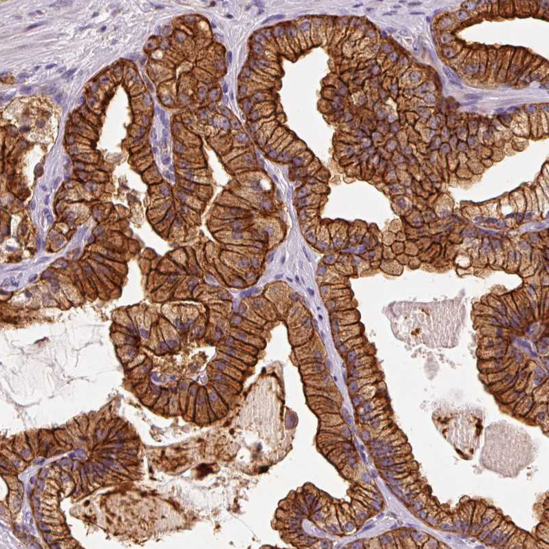 Anti-IQGAP2 Antibody