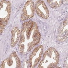 Immunohistochemical staining of human prostate shows moderate membranous and cytoplasmic positivity in glandular cells.
