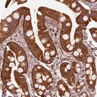 Immunohistochemical staining of human small intestine shows strong membranous and cytoplasmic positivity in glandular cells.