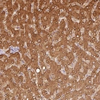 Immunohistochemical staining of human liver shows moderate cytoplasmic positivity in hepatocytes.