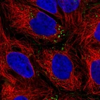 Immunofluorescent staining of human cell line CACO-2 shows localization to plasma membrane & vesicles.