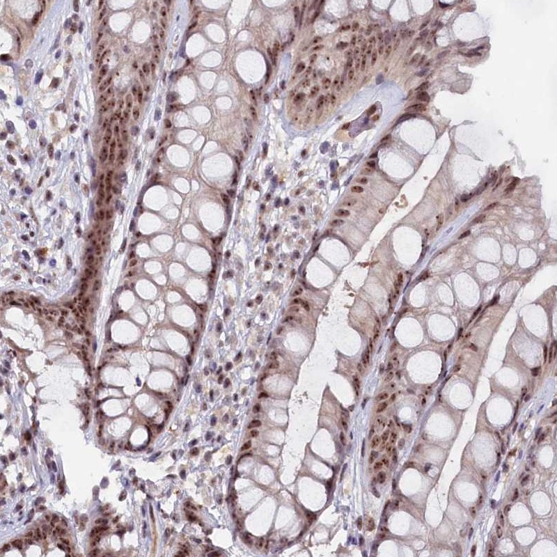 Anti-C1D Antibody