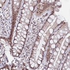 Anti-C1D Antibody