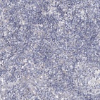 Immunohistochemical staining of human tonsil shows low expression as expected.