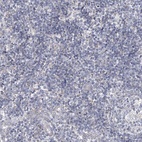 Anti-SNX7 Antibody