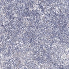Immunohistochemical staining of human tonsil shows low expression as expected.