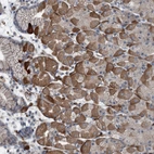 Anti-AXL Antibody