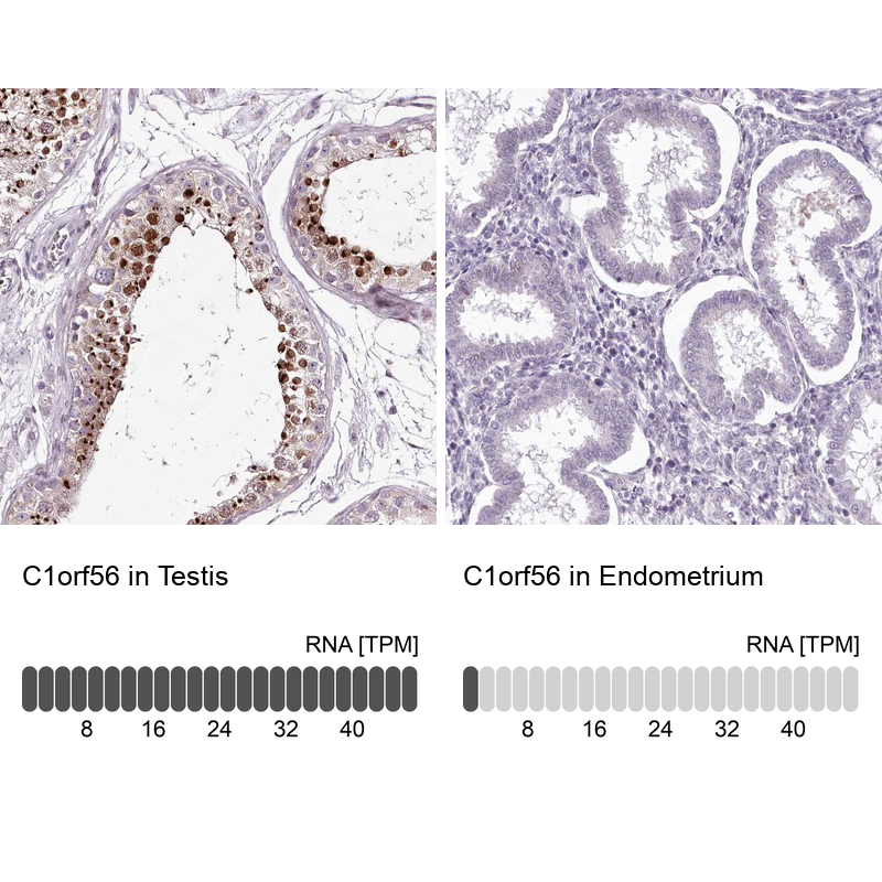 Anti-C1orf56 Antibody
