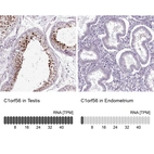 Anti-C1orf56 Antibody