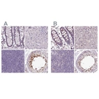 Immunohistochemical staining of human colon, liver, lymph node and testis using Anti-C1orf56 antibody HPA037430 (A) shows similar protein distribution across tissues to independent antibody HPA037429 (B).
