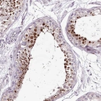 Immunohistochemical staining of human testis shows high expression.