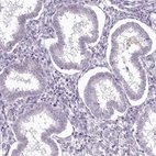 Immunohistochemical staining of human endometrium shows low expression as expected.