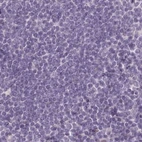 Immunohistochemical staining of human lymph node using Anti-C1orf56 antibody HPA037430.