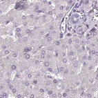 Immunohistochemical staining of human liver using Anti-C1orf56 antibody HPA037430.