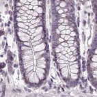 Immunohistochemical staining of human colon using Anti-C1orf56 antibody HPA037430.