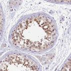 Anti-PDE6D Antibody