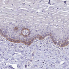 Anti-PDE6D Antibody